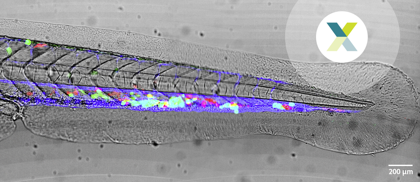 Metastasierende Prostatatumorzellen im Zebrafisch